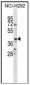 CD86 Polyclonal Antibody                                            